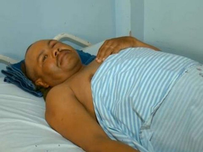 Βραζιλία: Ταξιτζής ταξίδεψε επί δύο ώρες με ένα μαχαίρι καρφωμένο στο κεφάλι του brazilian