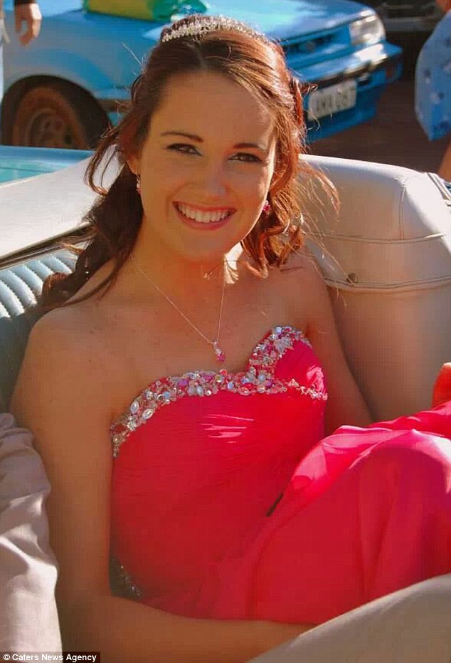 Kάηκε το δέρμα 19χρονη από μέσα προς τα έξω από λάθος φάρμακο danika1