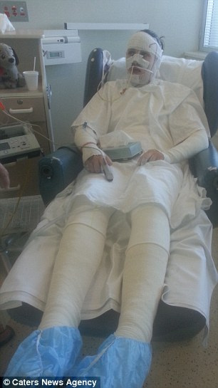 Kάηκε το δέρμα 19χρονη από μέσα προς τα έξω από λάθος φάρμακο egk-5