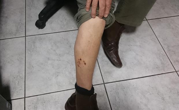 Σκύλος επιτέθηκε σε οδηγό μηχανής στο Ηράκλειο